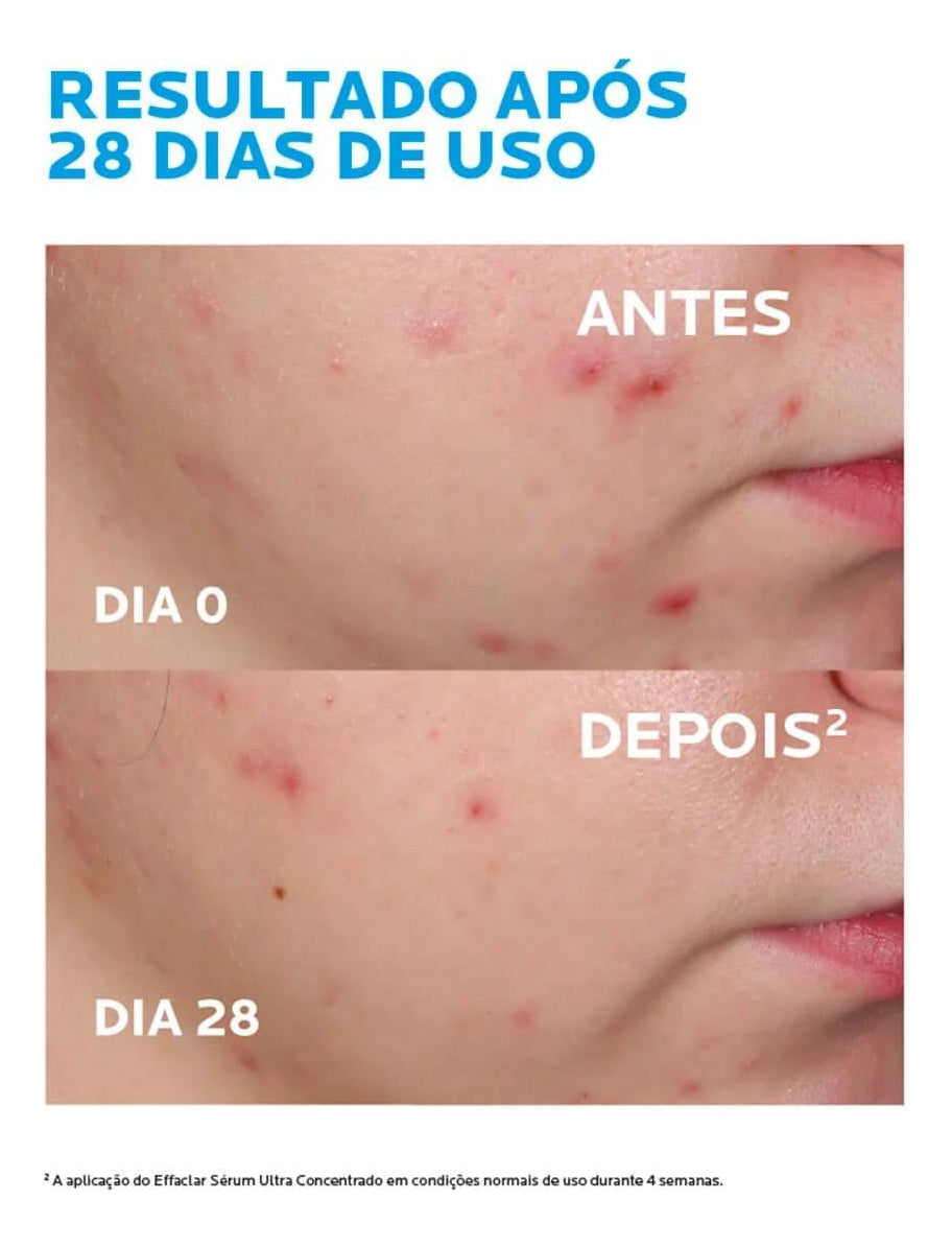EFFACLAR SÉRUM ULTRA CONCENTRADO 15ml